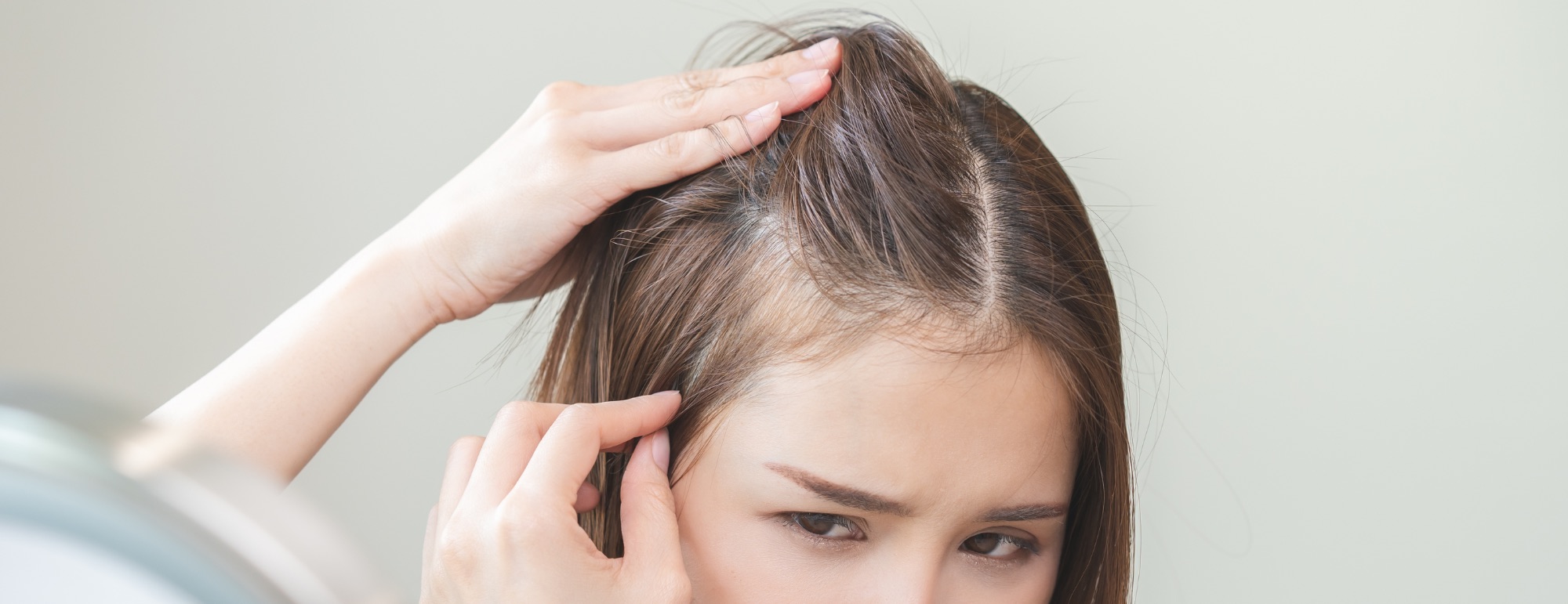 Eflúvio Telógeno vs Alopecia Androgenética: como entender a queda de cabelo